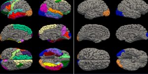 Brain scans show teen girls aged 4 years faster than boys during COVID lockdowns. We asked the researcher what that means long-term.