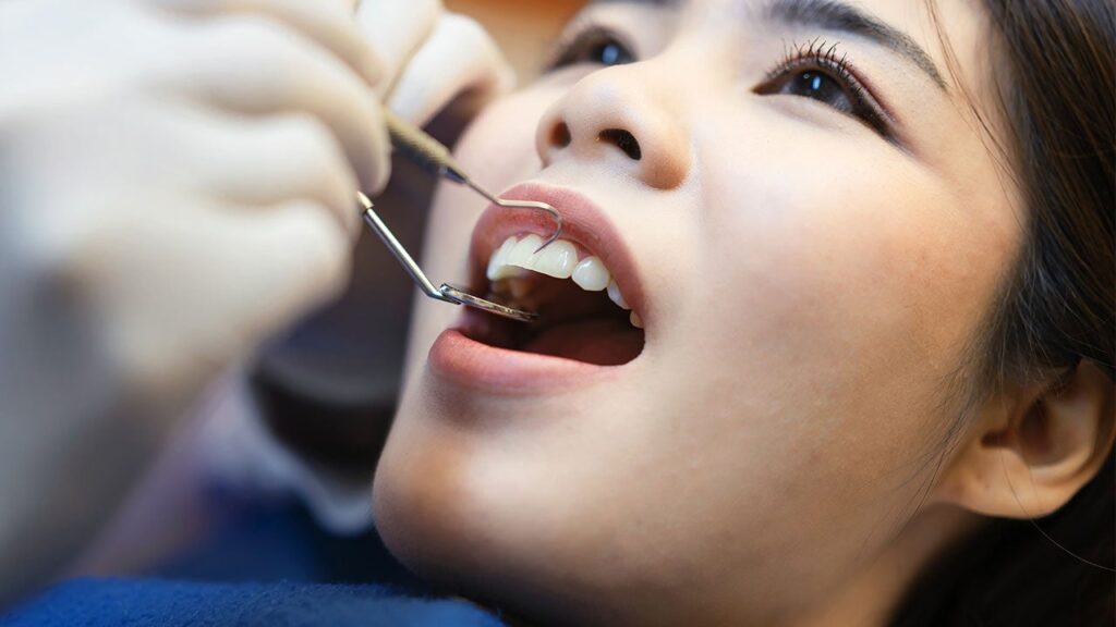 Dental Loans: How to Finance Dental Costs